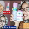 Produk cetaphil khusus untuk kulit berjerawat