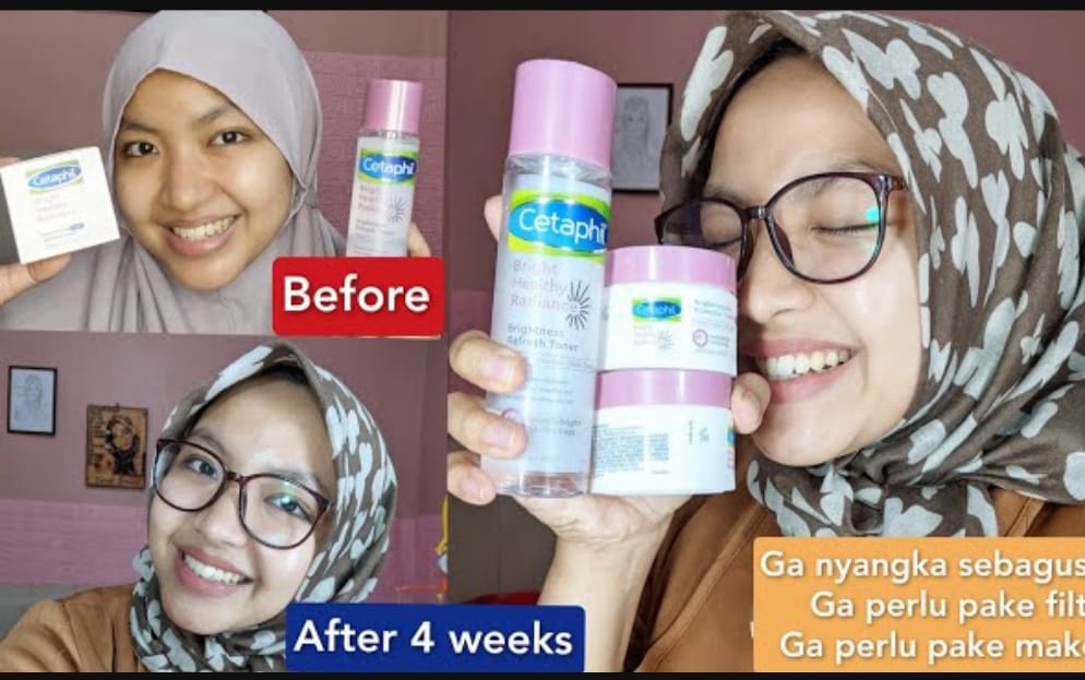 Produk cetaphil khusus untuk kulit berjerawat