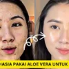 aloe vera untuk jerawat