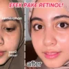 Cara memakai Retinol yang Benar