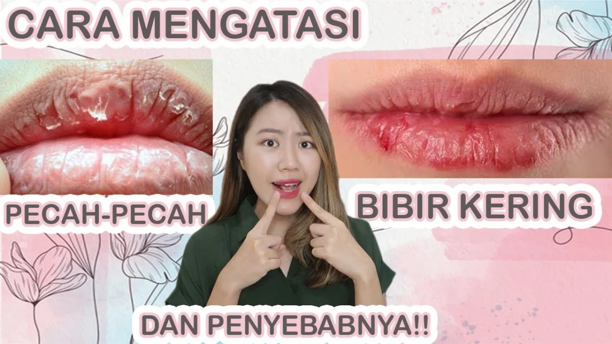 cara mengatasi bibir kering secara alami