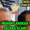 mengatasi uban di usia muda