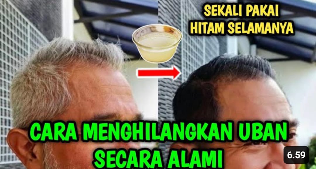 mengatasi uban di usia muda