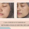 cara menghilangkan bintik hitam di wajah