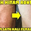 cara menghilangkan flek hitam