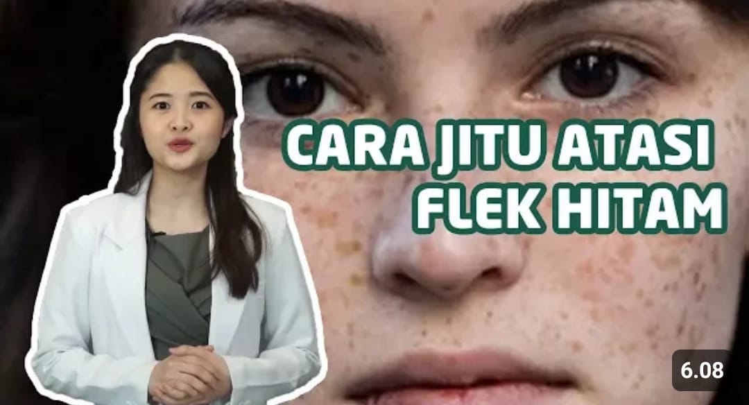 cara menghilangkan flek hitam dalam 1 jam