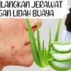 Cara menghilangkan jerawat dengan lidah buaya