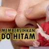 cara menghilangkan komedo hitam