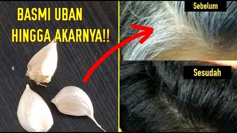 cara menghilangkan uban secara alami agar tidak tumbuh lagi