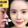 cara mudah menghilangkan bekas jerawat