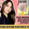 cara menghilangkan bulu ketiak dengan bedak bayi