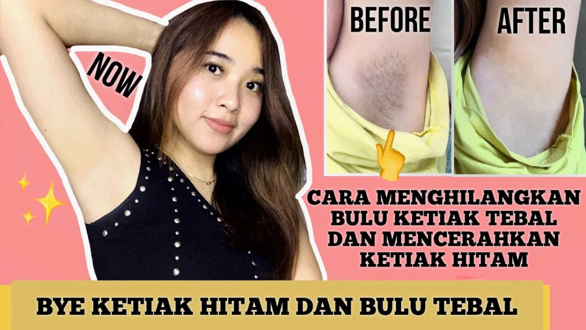 cara menghilangkan bulu ketiak dengan bedak bayi