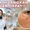 kebiasaan yang menyebabkan flek hitam