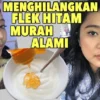 Cara menghilangkan flek hitam di wajah