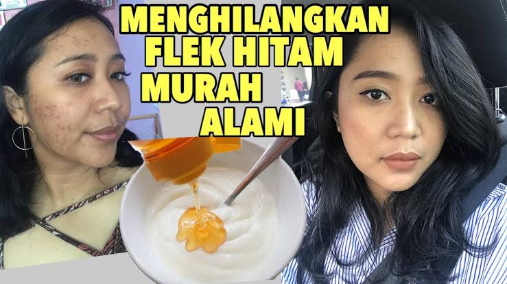 Cara menghilangkan flek hitam di wajah