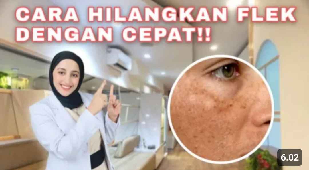 kebiasaan yang menyebabkan flek hitam