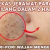 cara mengecilkan pori-pori wajah dengan cepat