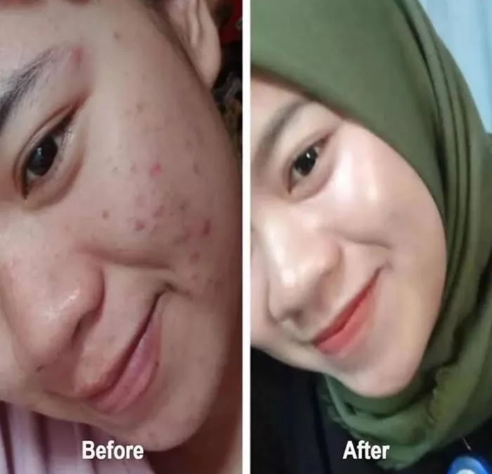 Bedak yang menjadikan cantik