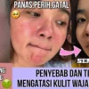 Rekomendasi bedak