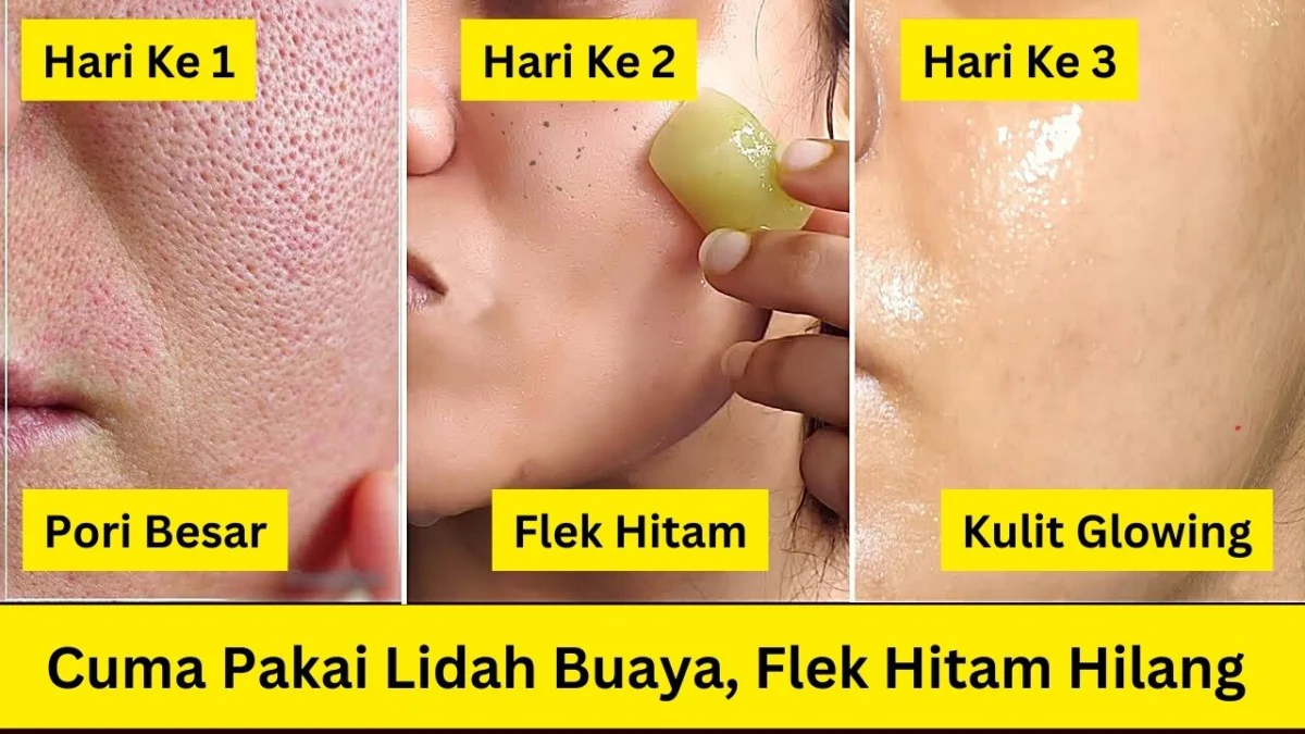 cara menggunakan lidah buaya untuk menghilangkan flek hitam di wajah