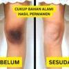 cara menghilangkan lutut hitam