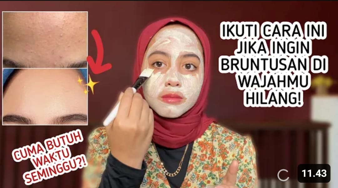 masker untuk menghilangkan bruntusan