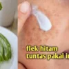 menghilangkan flek hitam dengan lidah buaya