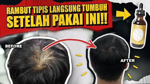 cara menggunakan minyak kemiri untuk rambut