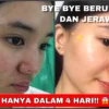 sabun muka untuk menghilangkan komedo dan jerawat untuk wanita