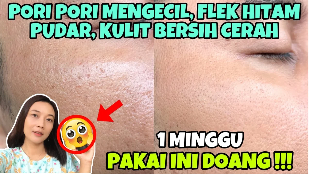 sabun cuci muka untuk mengecilkan pori-pori dan menghilangkan komedo