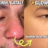 rekomendasi sabun cuci muka pria