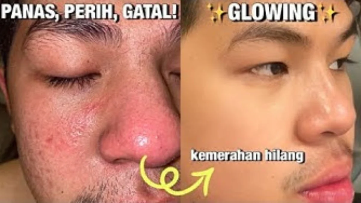 rekomendasi sabun cuci muka pria