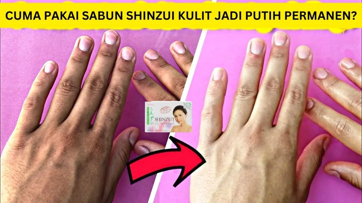 sabun shinzui yang memutihkan kulit