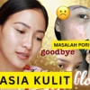 serum lokal untuk mengecilkan pori-pori dan menghilangkan bekas jerawat