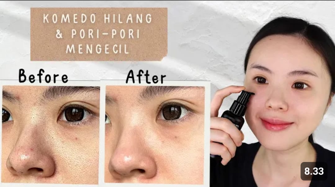 serum pengecil pori