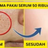 serum pengecil pori-pori terbaik