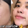 serum untuk menghilangkan bruntusan