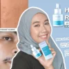 serum wardah untuk kulit berjerawat