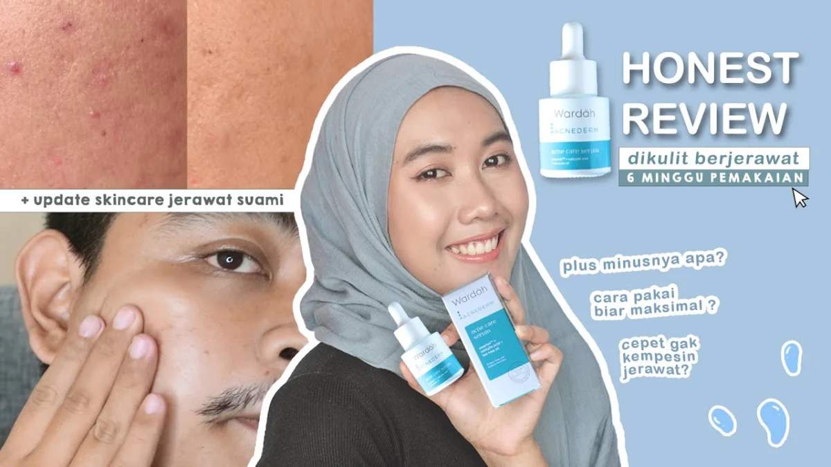 serum wardah untuk kulit berjerawat