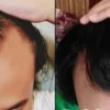 shampo penumbuh rambut dan penghilang uban