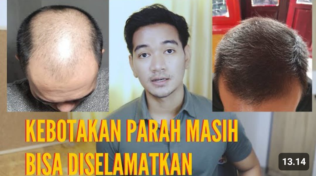 shampo untuk menumbuhkan rambut dengan cepat