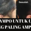 Shampo untuk uban