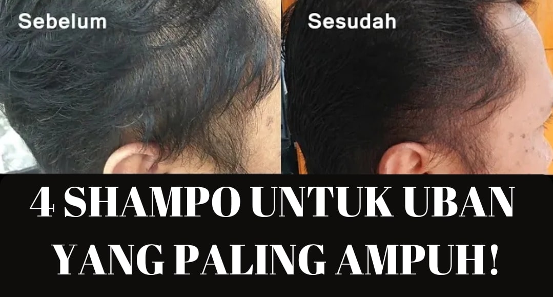 Shampo untuk uban