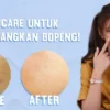 skincare untuk menghilangkan bopeng