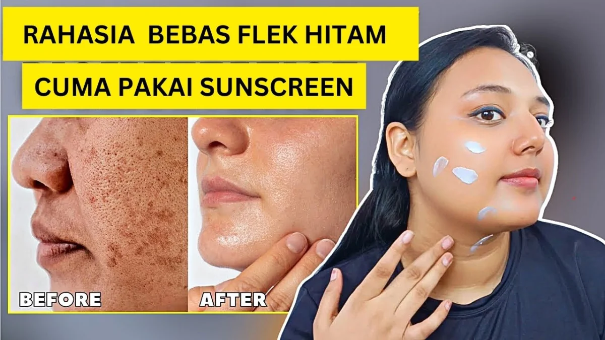 apakah sunscreen bisa menghilangkan flek hitam