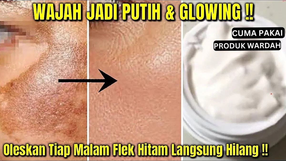 produk wardah untuk menghilangkan flek hitam