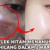 produk viva untuk menghilangkan flek hitam