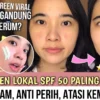 Apakah sunscreen Emina bisa menghilangkan bekas jerawat