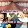 Cara Memutihkan Gigi dalam waktu 1 Hari