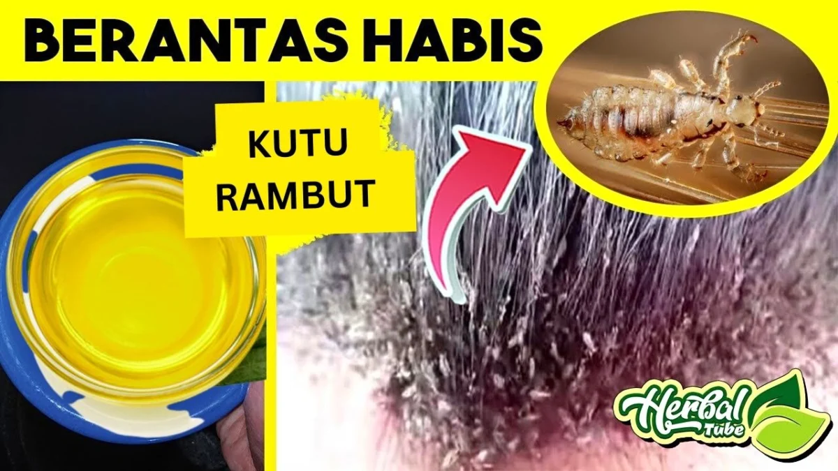 Cara menghilangkan kutu rambut dengan minyak zaitun